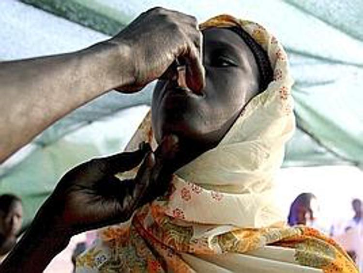 Msf, medicinali per epidemia colera in Sud Sudan
