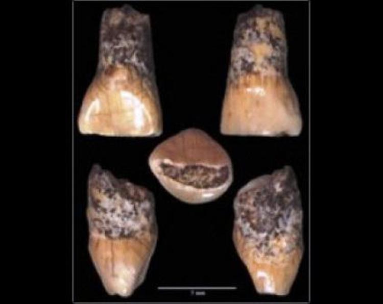 Isernia: Frattura, dente bimbo vissuto 600mila anni fa scoperta straordinaria