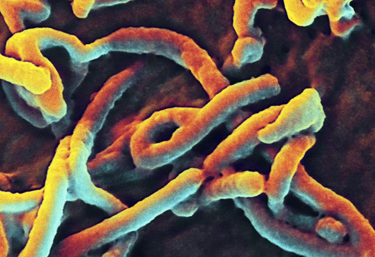 Nella foto, il virus Ebola (Infophoto)