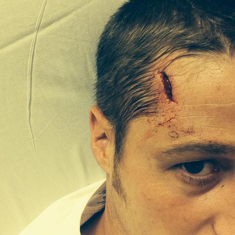 Benjamin McKenzie ferito alla fronte (Instagram)