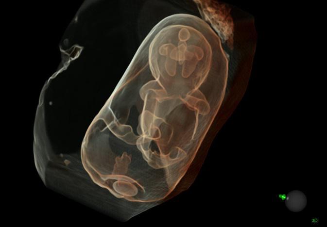 In pochi secondi disponibili  immagini precise di vasi sanguigni, cuore, cervello e altri organi del feto