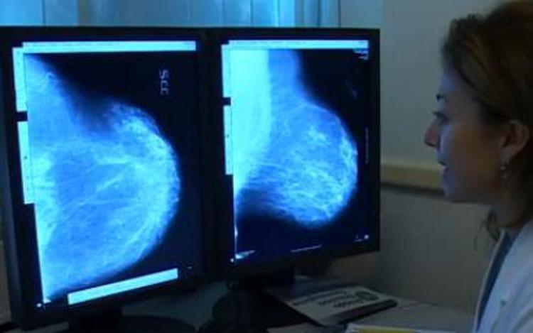 Tumori: per oncologi Usa troppi falsi positivi, meno mammografie