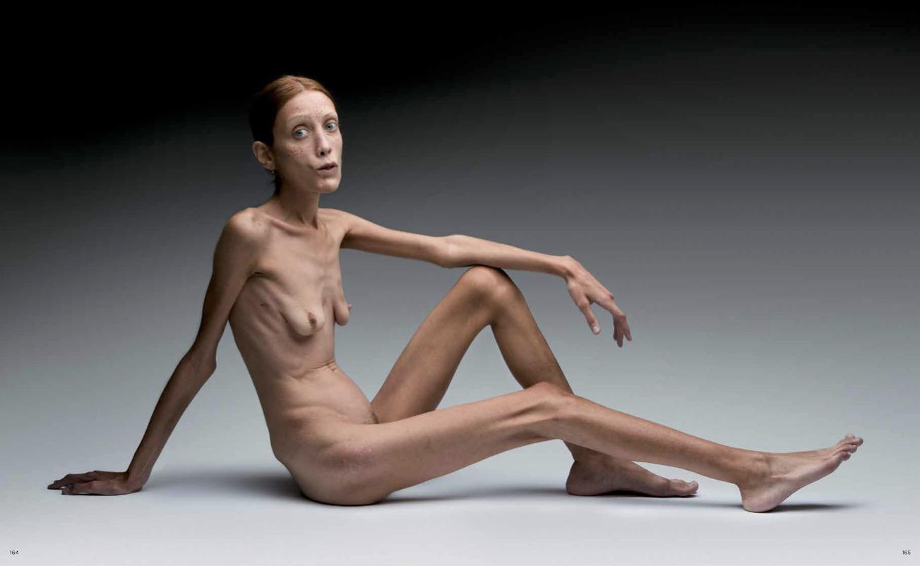 'No Anorexia' Campagna pubblicitaria per No.l.ita del 2007 Immagine tratta dal libro 'Più di 50 Anni di Magnifici Fallimenti'