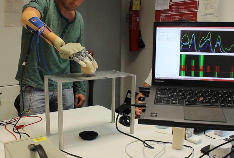 Un paziente testa la mano bionica