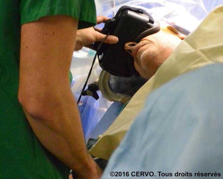 Il paziente operato da sveglio e in realtà virtuale al Chu di Angers (Francia)   - 2016 CERVO