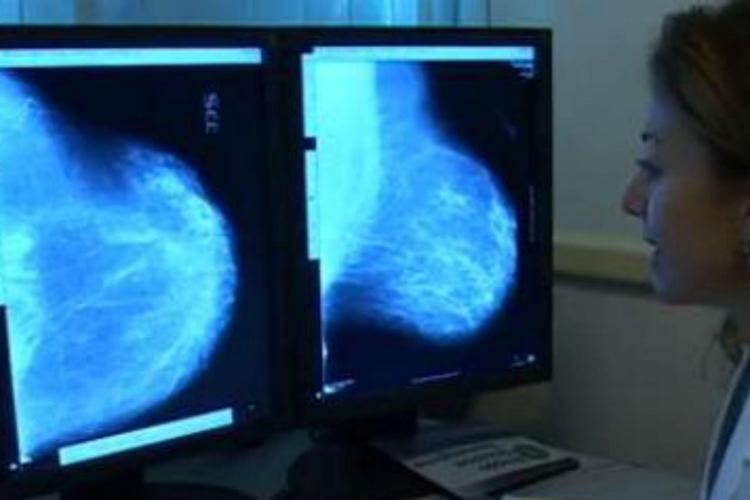 Asportato un tumore al seno di 15 kg, eccezionale intervento a Roma
