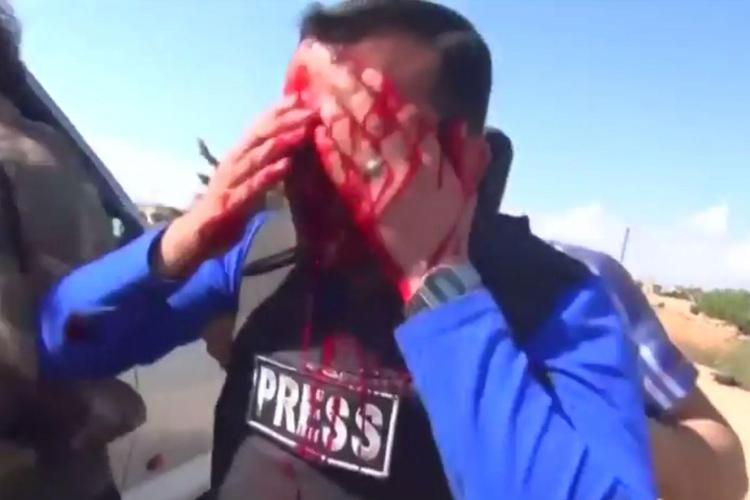 Il reporter di Orient News Ebrahim al-Khateeb, colpito al volto da una scheggia di una granata (fonte Youtube /Ace Williams)