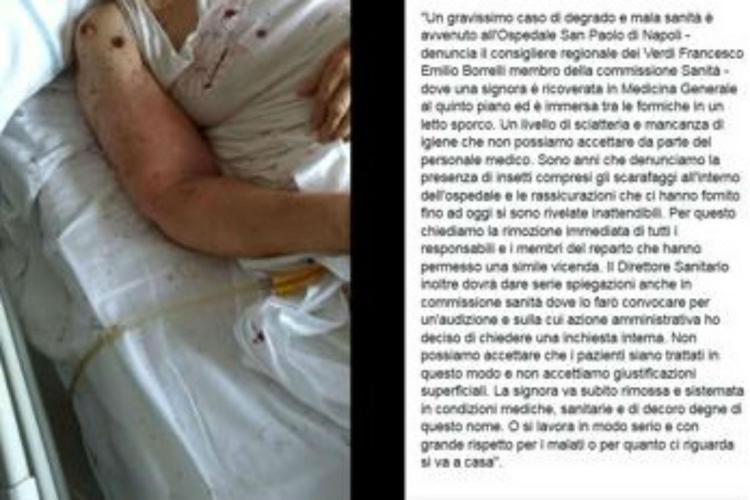 Napoli, choc in ospedale: paziente a letto tra le formiche