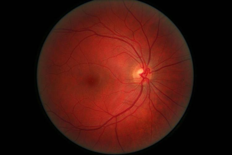 Ricerca: esperto Tigem, virus terapeutici per 'correggere' difetti retina