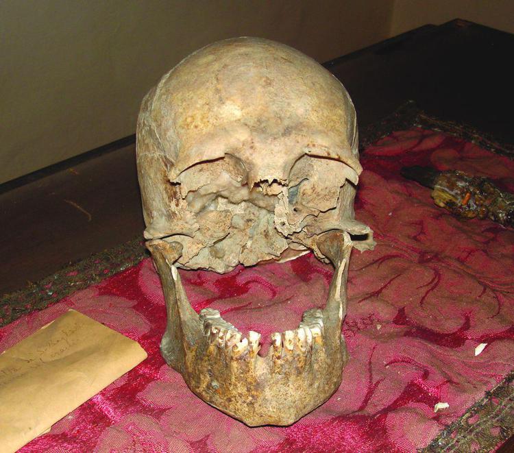 Il cranio conservato presso l'Accademia di Arte Sanitaria al centro del 'Progetto Plinio' - Accademia di Arte Sanitaria