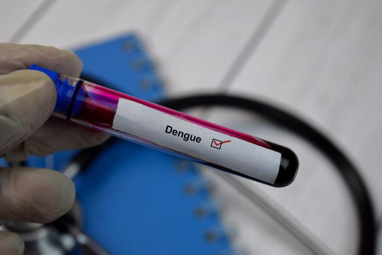 Esame del sangue per Dengue - (Foto 123RF)