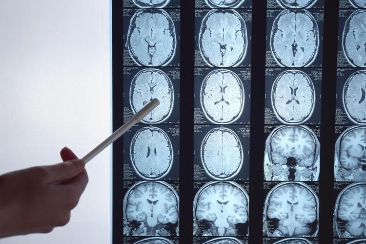 Radiografia del cervello - 


