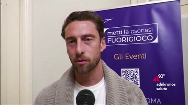Marchisio, 'non nascondo più psoriasi, testimonial campagna per aiutare altri'