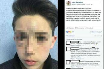 Figlio picchiato da bulli, papà pubblica foto: Condividete, non deve succedere più Figlio picchiato da bulli, papà pubblica foto: Condividete, non deve succedere più
