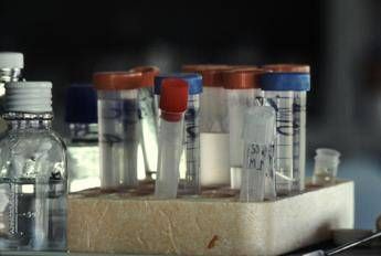 Aids, bimba guarita da Hiv: da 8 anni senza farmaci Aids, bimba guarita da Hiv: da 8 anni senza farmaci