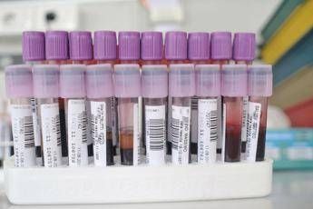 Alzheimer infettivo? Potrebbe trasmettersi col sangue Alzheimer infettivo? Potrebbe trasmettersi col sangue