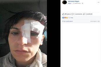 Un topo mi è saltato in faccia, la denuncia su Fb di una ragazza di Salerno Un topo mi è saltato in faccia, la denuncia su Fb di una ragazza di Salerno