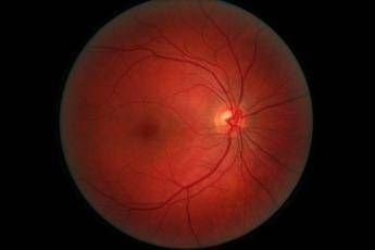 Ricerca, esperto Tigem: virus terapeutici per 'correggere' difetti retina Ricerca, esperto Tigem: virus terapeutici per 'correggere' difetti retina
