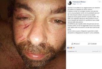 Napoli, ex assessore aggredito da baby gang Napoli, ex assessore aggredito da baby gang