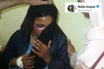Morta Asma, cristiana bruciata viva in Pakistan Morta Asma, cristiana bruciata viva in Pakistan