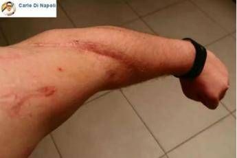 In treno col machete, post choc del pendolare In treno col machete, post choc del pendolare