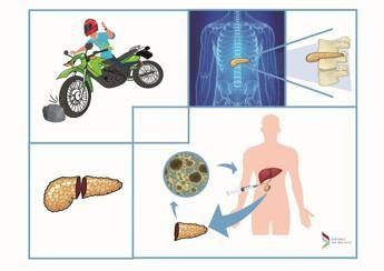 Pancreas ricreato nel fegato, salvo giovane motociclista Pancreas ricreato nel fegato, salvo giovane motociclista