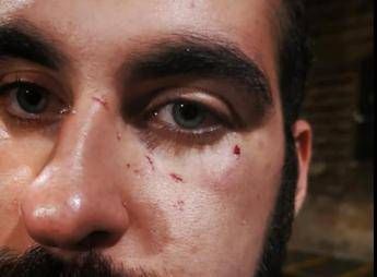 Paese di m..., coppia gay aggredita posta foto su Fb Paese di m..., coppia gay aggredita posta foto su Fb
