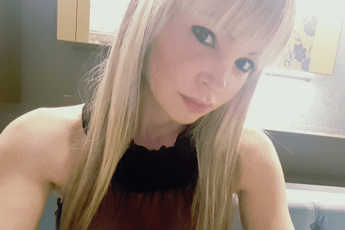 Mi hanno rovinato, parla l'ex modella sfigurata Mi hanno rovinato, parla l'ex modella sfigurata