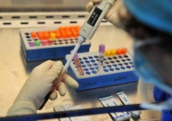 Aids, nuova strategia per dare scacco matto all'Hiv con cellule bimbi /Video Aids, nuova strategia per dare scacco matto all'Hiv con cellule bimbi /Video