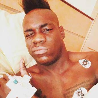 Intervento ok per Balotelli, tornerà tra un mese Intervento ok per Balotelli, tornerà tra un mese