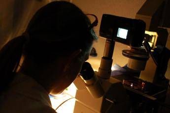 'Può causare ictus e Alzheimer', scoperto il killer dei neuroni 'Può causare ictus e Alzheimer', scoperto il killer dei neuroni