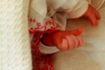 Palermo, neonata azzannata al volto dal cane di casa Palermo, neonata azzannata al volto dal cane di casa