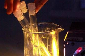 Ricerca, svelato nuovo gene della Sla Ricerca, svelato nuovo gene della Sla
