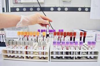 Alzheimer, neutralizzato gene chiave Alzheimer, neutralizzato gene chiave