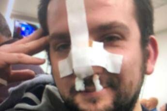 Cronista Adnkronos pestato a sangue in pieno centro a Roma Cronista Adnkronos pestato a sangue in pieno centro a Roma