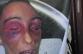 Cucchi, l'infermiera: Disse che l’avevano picchiato i carabinieri Cucchi, l'infermiera: Disse che l’avevano picchiato i carabinieri