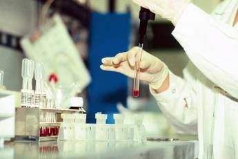 Ha l'Hiv ma non lo dice: arrestato Ha l'Hiv ma non lo dice: arrestato