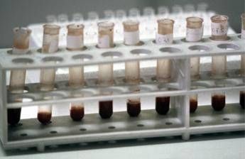 Fabbricare il sangue in laboratorio, il traguardo è più vicino Fabbricare il sangue in laboratorio, il traguardo è più vicino