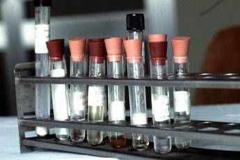 Mutazioni del gene Fa2h, famiglia calabrese 'sotto la lente' Mutazioni del gene Fa2h, famiglia calabrese 'sotto la lente'