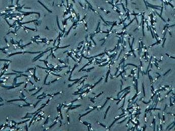 Ricerca: nella polvere di casa 9 mila germi tra batteri e funghi Polvere in casa
