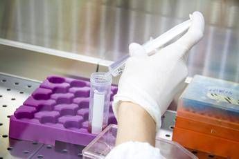 Cnr scopre la causa del Parkinson giovanile, è un meccanismo molecolare che media la morte neuronale Cnr scopre la causa del Parkinson giovanile, è un meccanismo molecolare che media la morte neuronale
