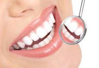 Sorrisi hollywoodiani 'fai da te', i rischi per denti e bocca Sorrisi hollywoodiani 'fai da te', i rischi per denti e bocca