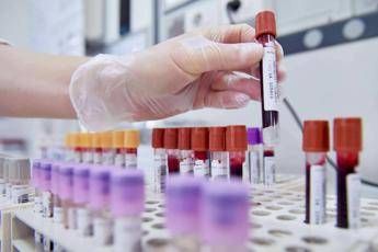 Piede diabetico, nuova tecnica al Neuromed Piede diabetico, nuova tecnica al Neuromed