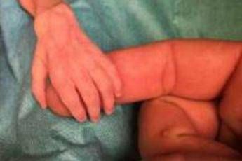 Miracolo di Natale a Milano, intervento record su un bebè di 750 grammi /Foto Miracolo di Natale a Milano, intervento record su un bebè di 750 grammi /Foto