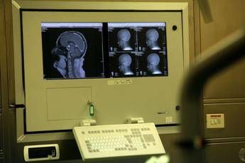 AAA cercasi donatori di cervello AAA cercasi donatori di cervello