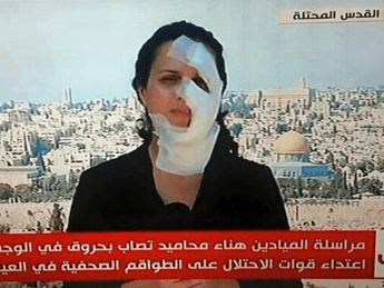 Torna in tv Hana Mahameed, la giornalista colpita in faccia da una granata /Video Torna in tv Hana Mahameed, la giornalista colpita in faccia da una granata /Video