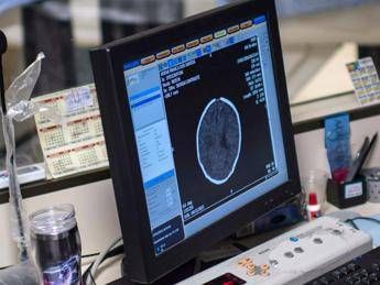 Trovata la culla della schizofrenia Trovata la culla della schizofrenia