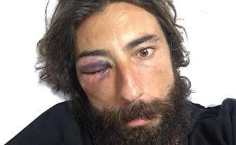 Brumotti di 'Striscia' e il padre aggrediti, lui twitta: Non odiate gli stranieri Brumotti di 'Striscia' e il padre aggrediti, lui twitta: Non odiate gli stranieri