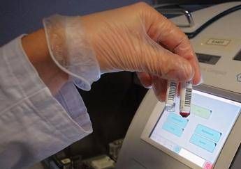 Omicidio Garlasco, il genetista: Inattendibile Dna su unghie Chiara Omicidio Garlasco, il genetista: Inattendibile Dna su unghie Chiara