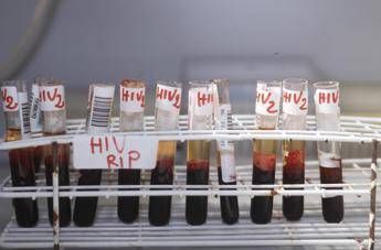 Aids, vero e falso Aids, vero e falso